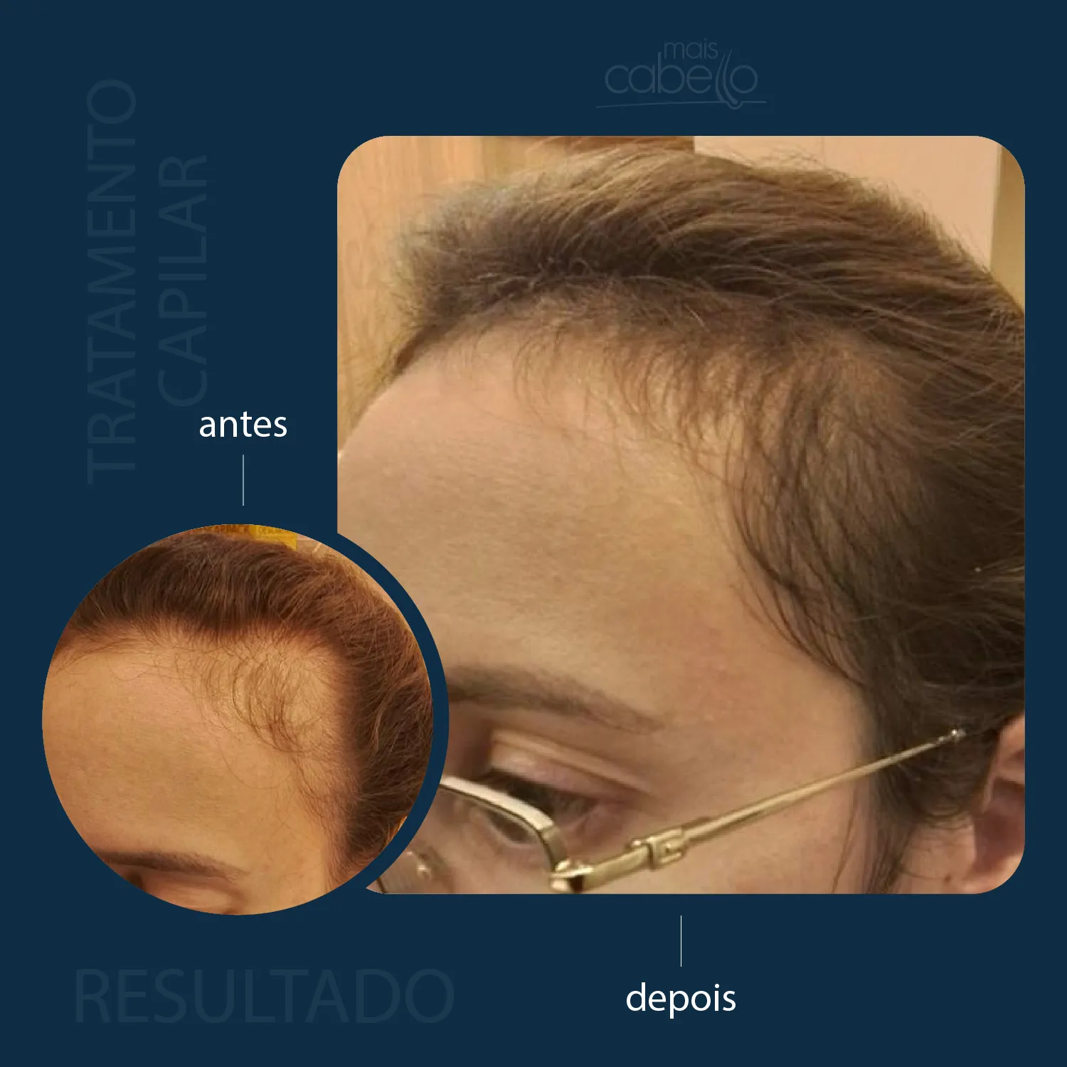 Antes e Depois - Evolução Capilar